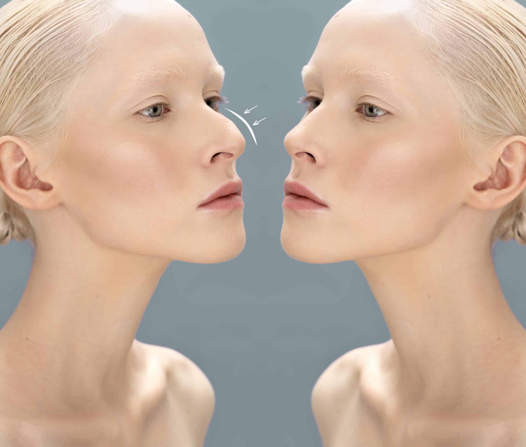 woman-getting-ready-nose-job-surgery (7)